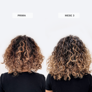 Vitamine Gommose Vegane per la Crescita dei Capelli - Trattamento di 3 mesi